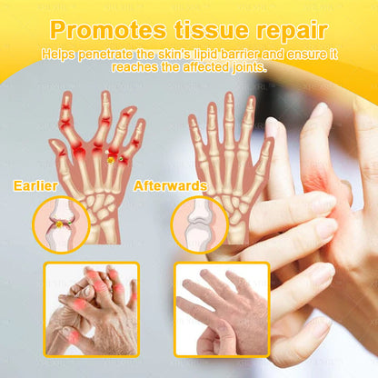 Pryxo® Bee Venom Pain-Relief Bone Healing Cream 🎉🎉(Specially for older adults)