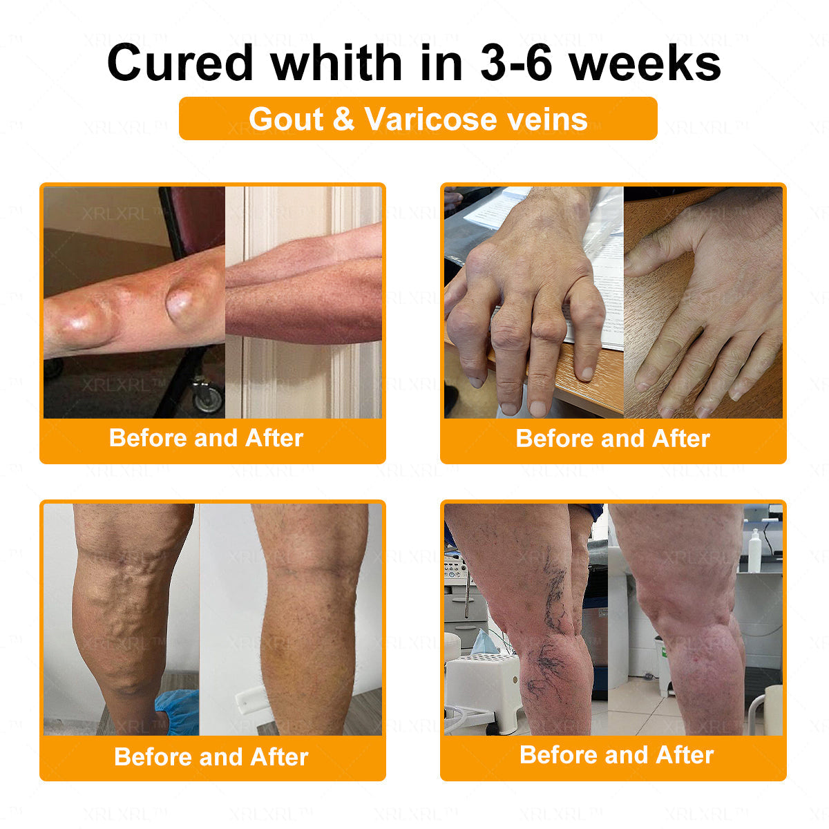 Pryxo® Bee Venom Pain-Relief Bone Healing Cream 🎉🎉(Specially for older adults)