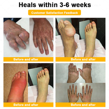 Pryxo® Bee Venom Pain-Relief Bone Healing Cream 🎉🎉(Specially for older adults)