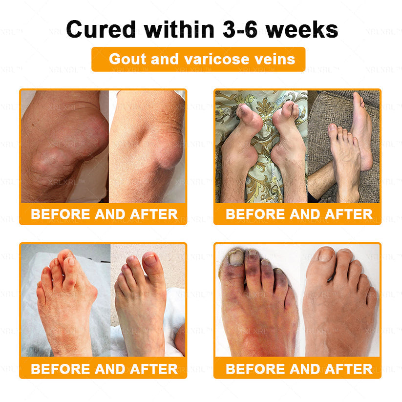 Pryxo® Bee Venom Pain-Relief Bone Healing Cream 🎉🎉(Specially for older adults)