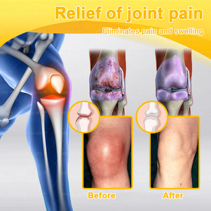 Pryxo® Bee Venom Pain-Relief Bone Healing Cream 🎉🎉(Specially for older adults)